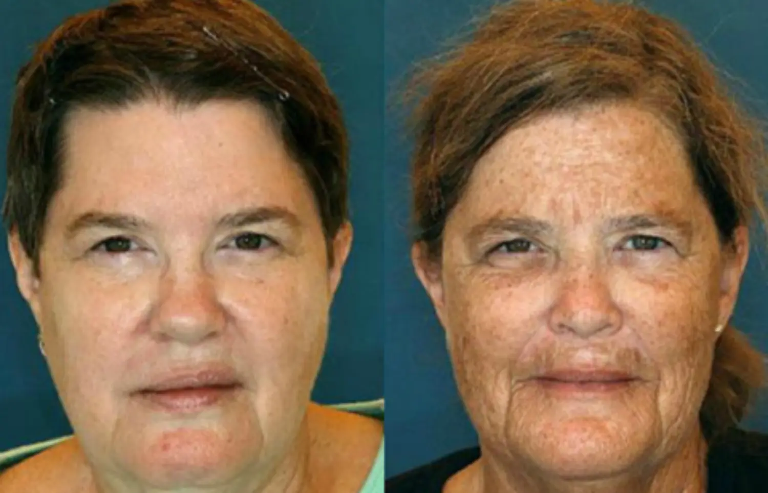 health-data-and-facial-analytics